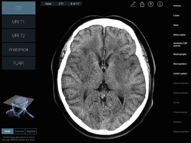 MRI & CT 一問一答セット CT診断一問一答: 研修医