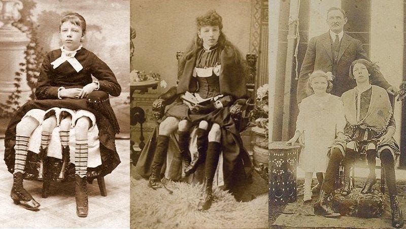 Incredible Lady Who Had Two Private Parts, Four Legs & Eight Children | by  Esh | Lessons from History | Medium