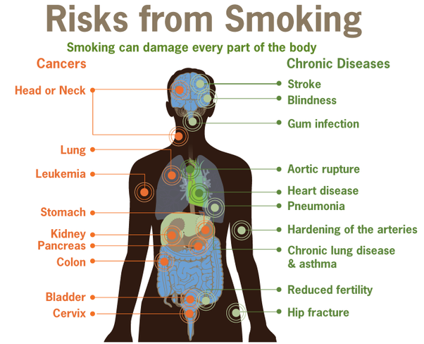 cigarette dictionary personal adornment and articles > personal articles > smoking accessories  image