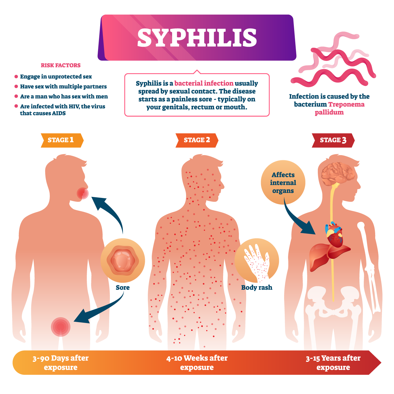 can you catch syphilis from sharing a cigarette and Congenital Syphilis - PAHO/WHO V.D.R.L ( SYPHILIS ). VDRL