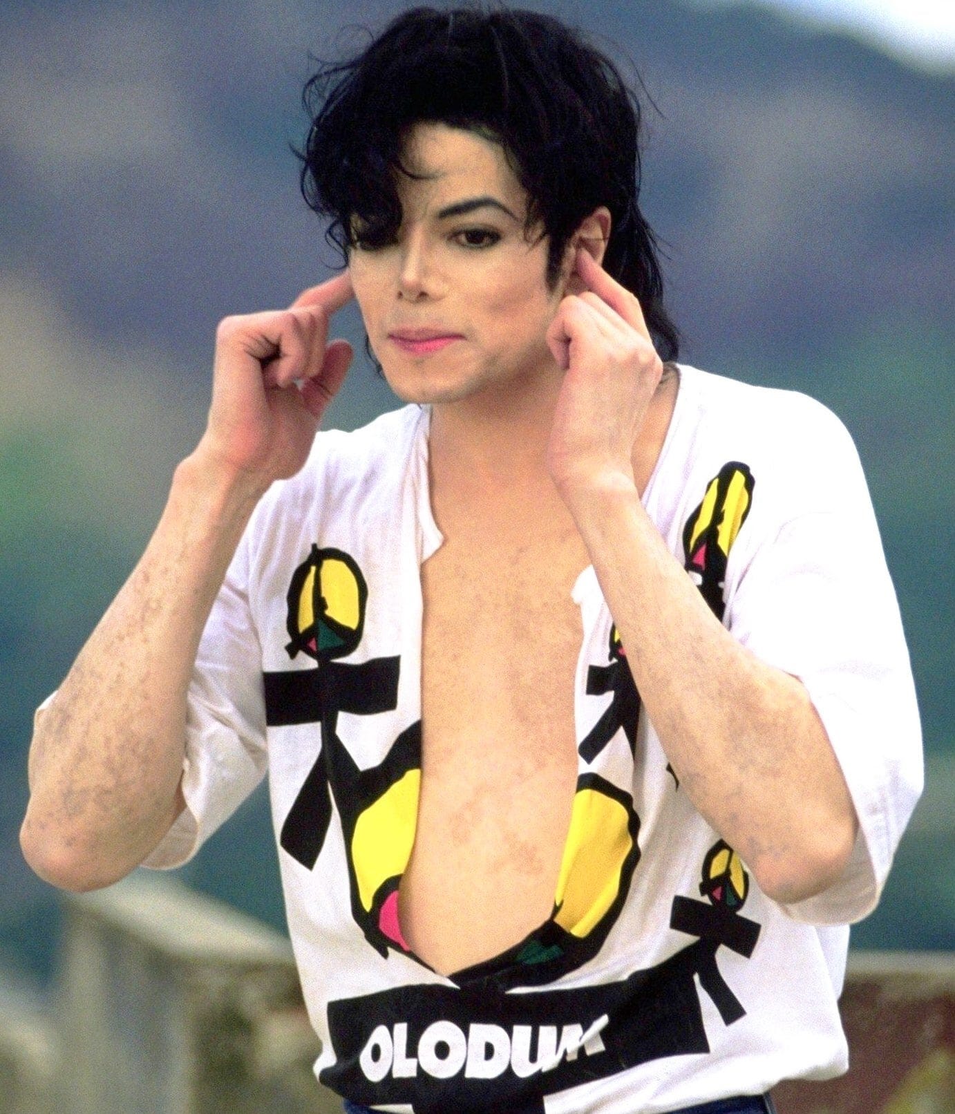 How Come Nobody Ever Apologizes to Michael Jackson: Vitiligo and Lupus | by  Decked Out Magazine | Medium, image size:1382x1612