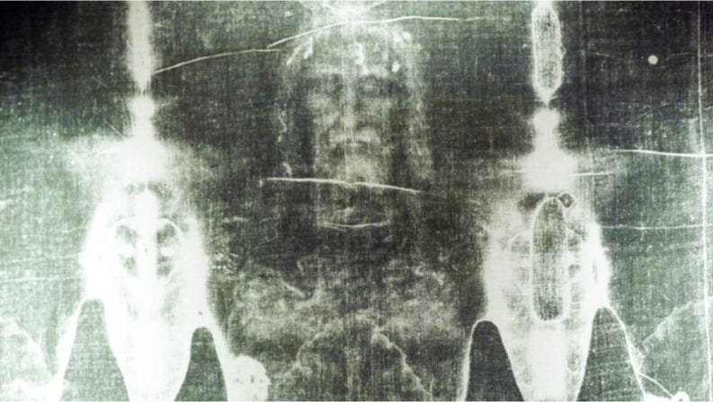 Forensic Ghost: AI Discovers Something “Impossible” in the Shroud of Jesus  | by Antoine Mekhail | Jan, 2026 | Medium