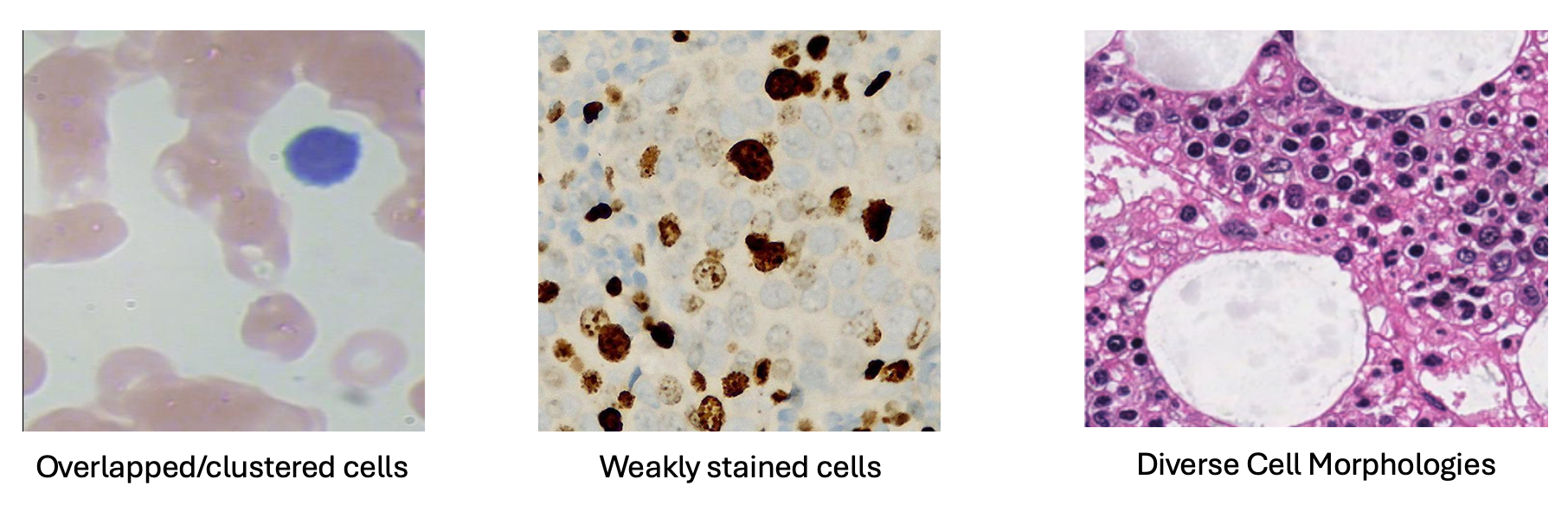 YOLO Blog #1: YOLO for Biomedical Images | by Johanna Jones | Medium, image size:1812x584