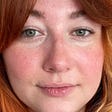 I Got A ‘Lip Flip’, The Lip Plumping Procedure Set To Rival Filler