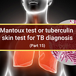 Mantoux test or tuberculin skin test for the diagnosis of TB (Part 15)