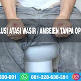 Berikut Adalah Ubat Buasir Yang Boleh Dibeli Di Farmasi Malaysia By Purnama Sari Ubat Buasir Di Malaysia Medium