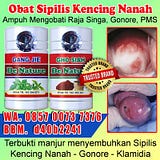 obatsipilisherbal