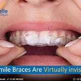 Invisible Braces in Pakistan