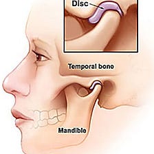 TMJ Ache Aid: 8 Finest Practices to Assist Handle Temporomandibular Joint Issues?