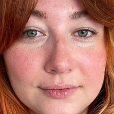 I Got A ‘Lip Flip’, The Lip Plumping Procedure Set To Rival Filler