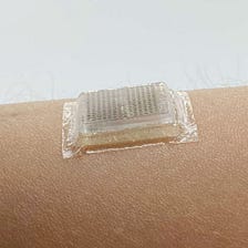 Personalized medicine takes a big step forward with this ultrasound patch