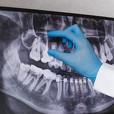 How often should you get dental x-rays?