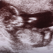 Abortionist Only Allows Pregnant People With ‘Wanted’ Babies to See Their Ultrasounds