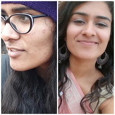 How I got rid of my Acne in a polluted city like Delhi