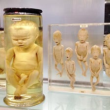 Preserving the future — close encounters with the macabre history of London’s Hunterian Museum