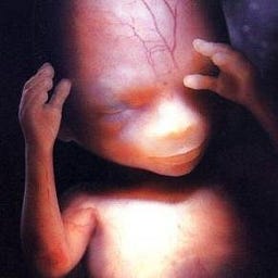 Cultureshift | In Defense of the Defenseless