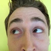 Brett Bagenstose