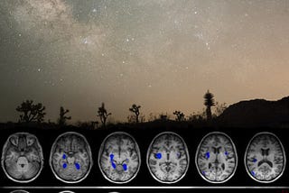 How My Brain Injury Sent Me Back in Time