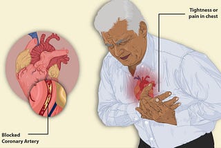 The Number One TestThat Predicts You Might Die Suddenly From A Heart Attack