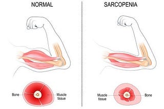 How You can stop Muscle Loss in Old Age