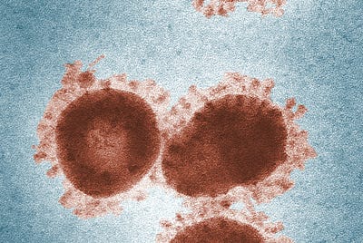 How Covid-19 Virus Overcomes The Human Immune System