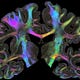 Brain Byte