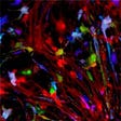 First Cell Culture of Live Adult Human Neurons Shows Potential of Brain Cell Types