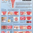 Gynecological Disorders List