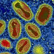 The smallpox virus (Variola major)