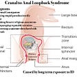 Christian Cranal to Anal Loopback Syndrome Photo