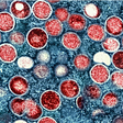 Monkeypox virus under magnification