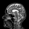 A scan of a human brain, lauren lynn bradley, medium