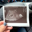 6 week ultrasound of our IVF miracle baby