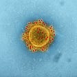 An image of a yellow coloured virus on a bright blue background.