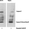 Cleaved-Caspase-9 (D353) Polyclonal Antibody Released