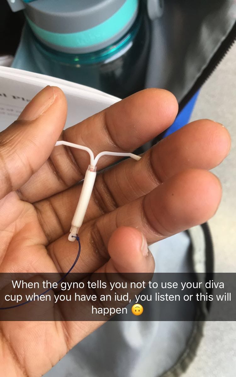 Is It Just Me Iud The Iud Symptom No One Told Me About By