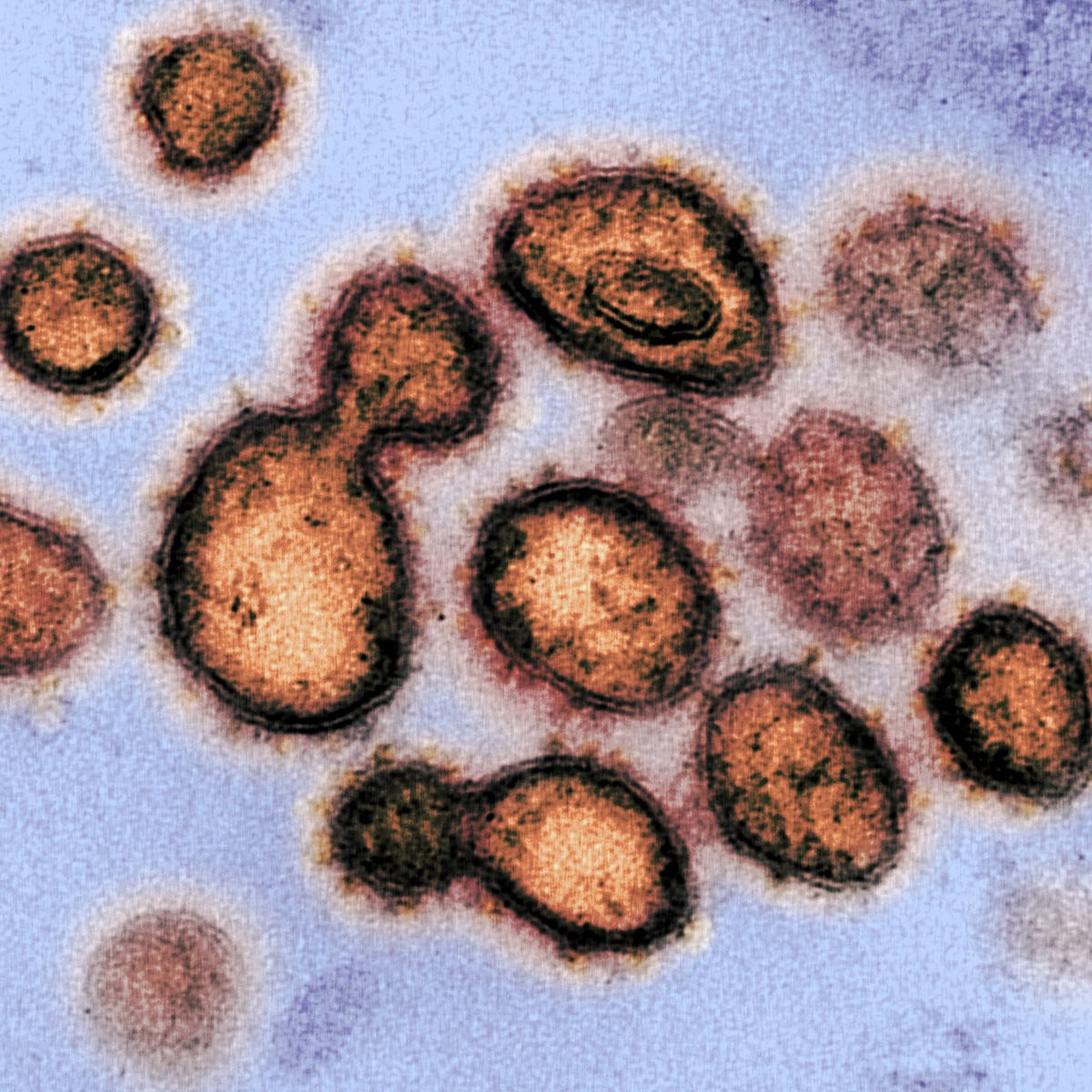 Is The Coronavirus Losing Potency as It Spreads? | Elemental