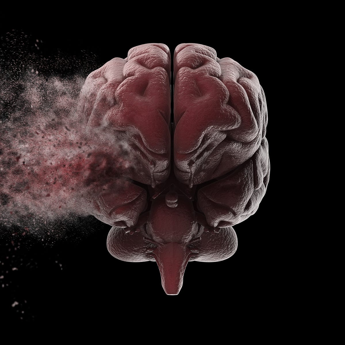 The Brain That Remade Itself Doctors Removed One Sixth Of This Boy S By Andrew Zaleski Onezero The Brain That Remade Itself Doctors Removed One Sixth Of This Boy S By Andrew Zaleski Onezero