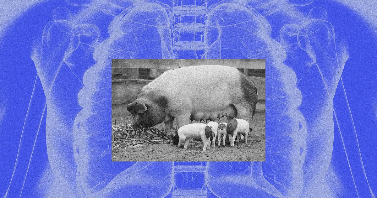 Hooking Up Human Lungs to Pigs Could Save Them for Transplant