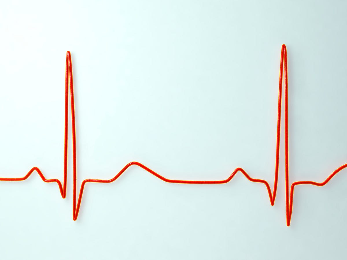 What is A Normal Resting Heart Rate? | Elemental