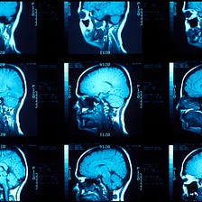 A Tiny Electric Brain Implant Could Wake People in Comas