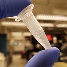 What Miniature Lab-Grown Brains Reveal About the Effects of Covid-19