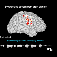 Researchers Are Translating Brain Activity Into Speech