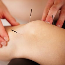 How Acupuncture Saved Me From Unbearable Knee Pain