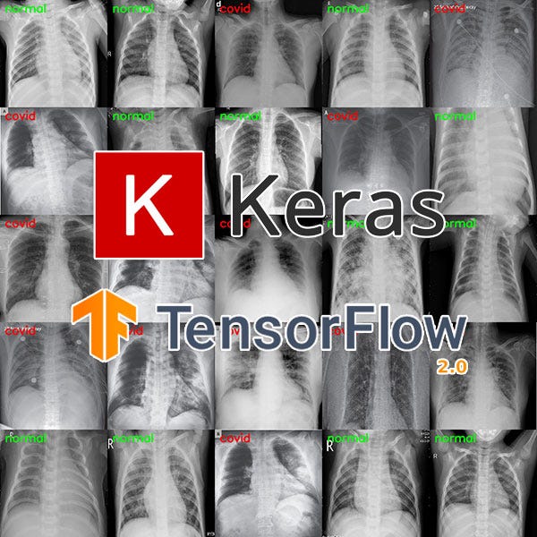 Detección de COVID-19 en imágenes de rayos X con Keras, TensorFlow y Deep Learning