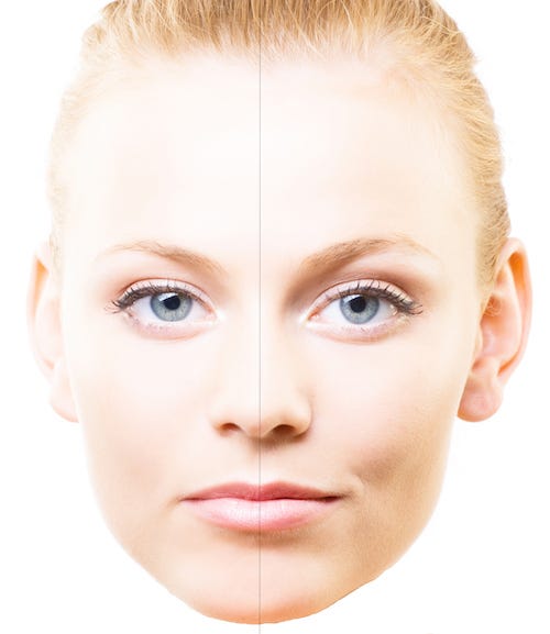 Does Facial Symmetry Matter Our Natural Affinity For Symmetry Is By Jen Chow Medium