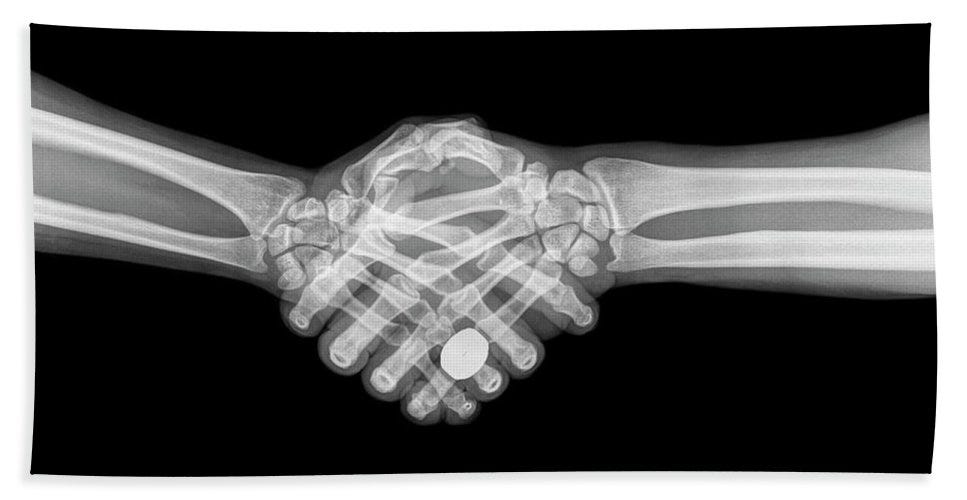 Training Networks to Identify X-rays with Pneumonia