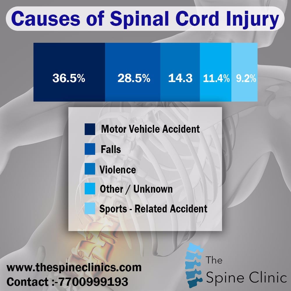 CAUSES OF SPINAL CORD INJURY. Spinal Cord gives important support to