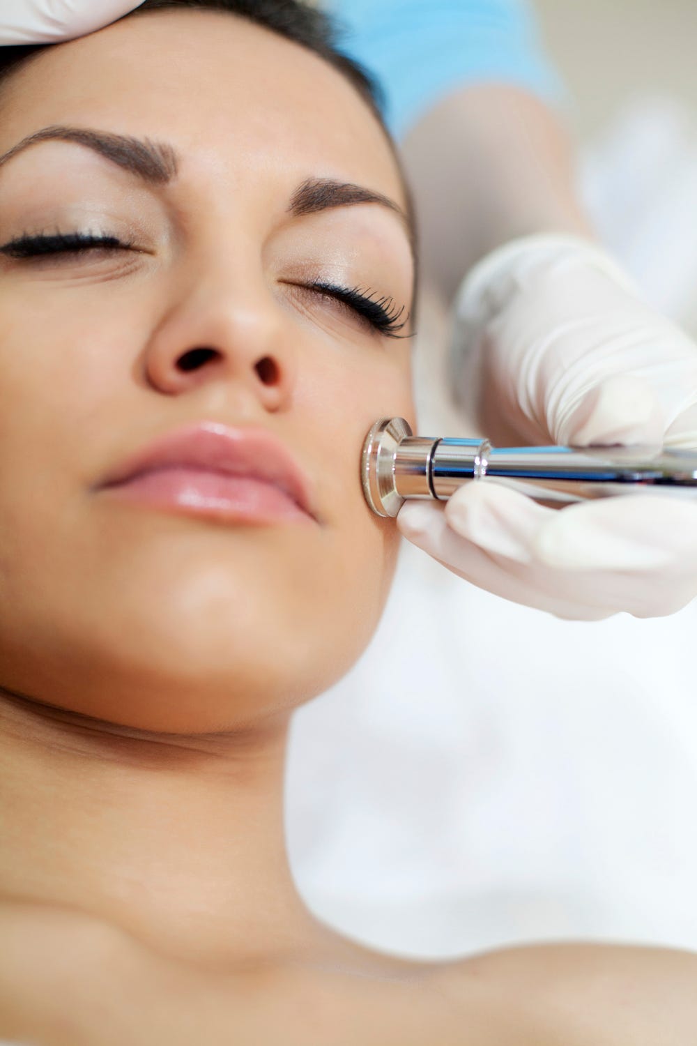 dermabrasion