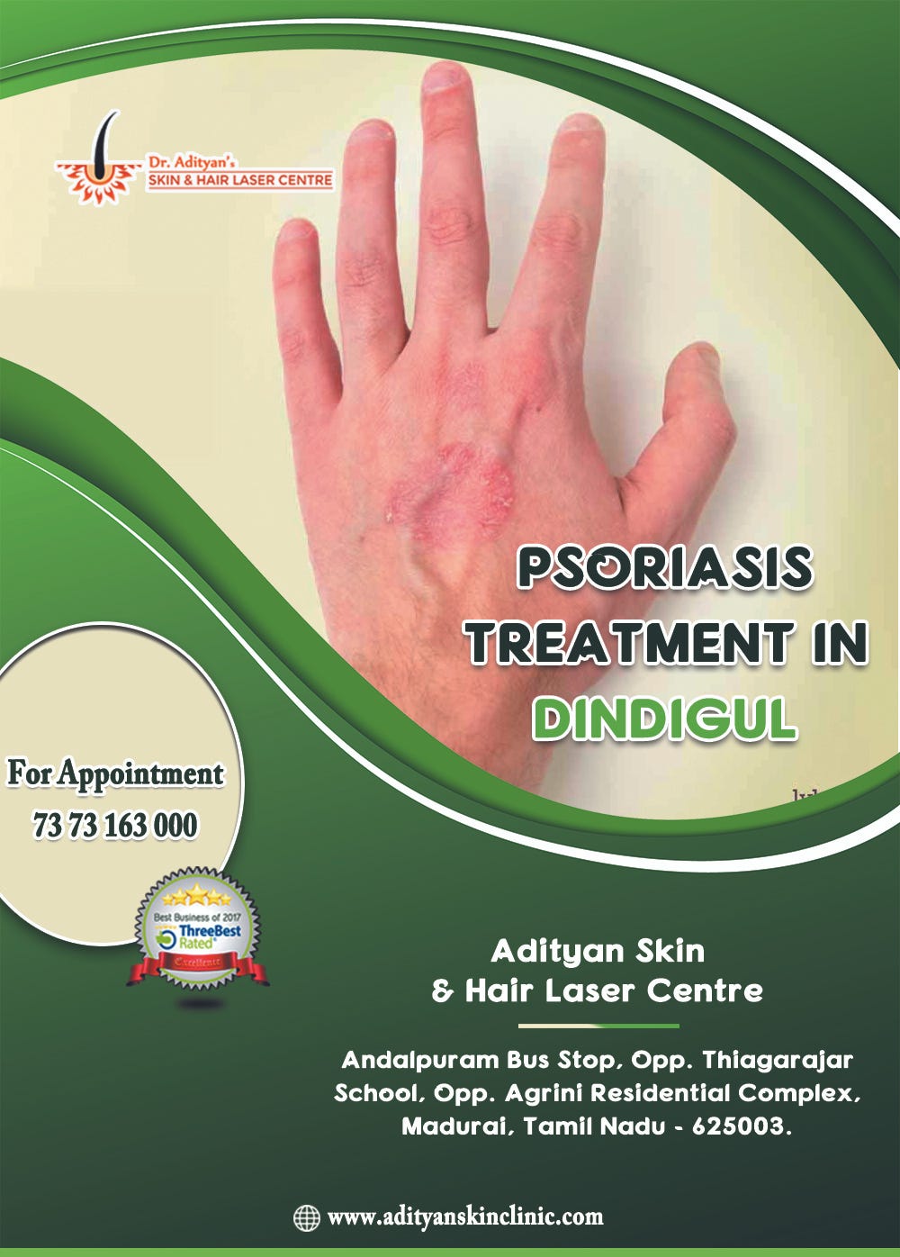 psoriasis treatment in tamil nadu